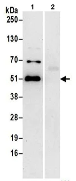 Immunoprecipitation - Anti-DDI2 antibody (AB197081)