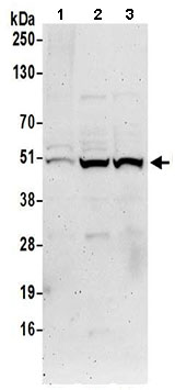 Western blot - Anti-DDI2 antibody (AB197081)
