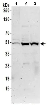 Western blot - Anti-DDI2 antibody (AB197081)