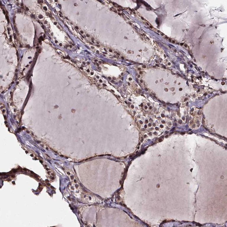 Immunohistochemistry (Formalin/PFA-fixed paraffin-embedded sections) - Anti-DDIT3 Antibody (AB327270)