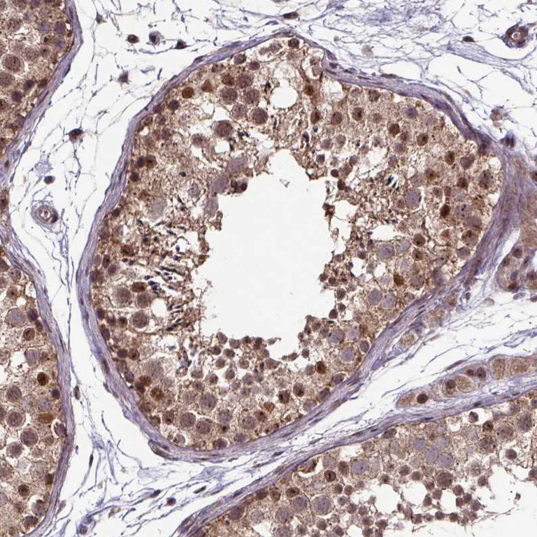 Immunohistochemistry (Formalin/PFA-fixed paraffin-embedded sections) - Anti-DDIT3 Antibody (AB327270)