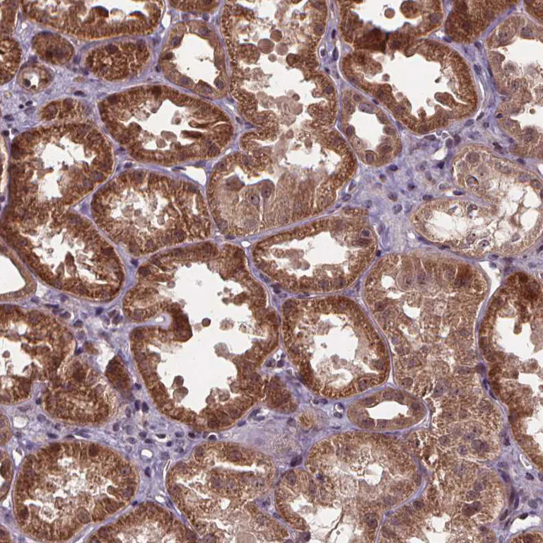 Immunohistochemistry (Formalin/PFA-fixed paraffin-embedded sections) - Anti-DDIT3 Antibody (AB327270)