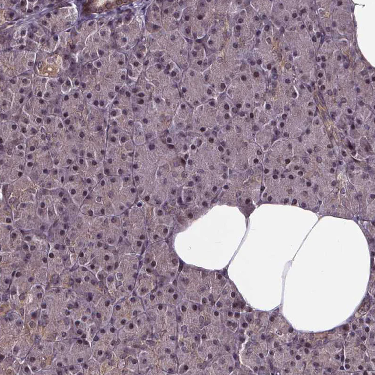 Immunohistochemistry (Formalin/PFA-fixed paraffin-embedded sections) - Anti-DDIT3 Antibody (AB327270)