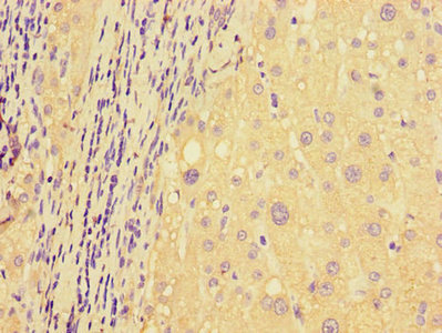 Immunohistochemistry (Formalin/PFA-fixed paraffin-embedded sections) - Anti-DDIT4L/REDD2 antibody (AB223034)