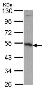 Western blot - Anti-DDOST antibody (AB151978)
