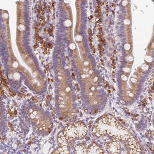 Immunohistochemistry (Formalin/PFA-fixed paraffin-embedded sections) - Anti-DDOST antibody (AB204314), expandable thumbnail