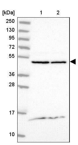 Western blot - Anti-DDOST antibody (AB204314), expandable thumbnail