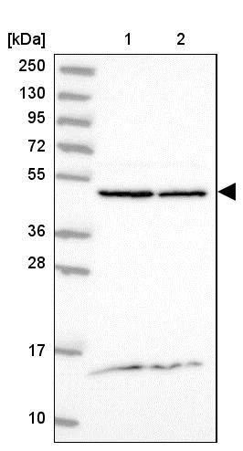 Western blot - Anti-DDOST antibody (AB204314)