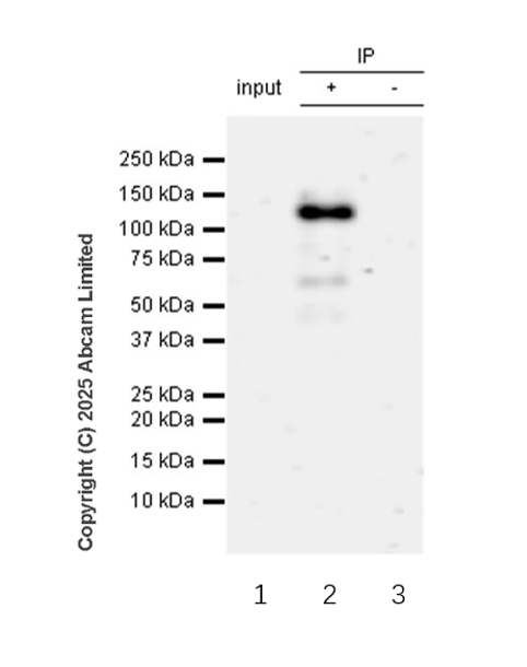 Immunoprecipitation - Anti-DDR1 (phospho Y796) + DDR2 (phospho Y740) antibody [EPR28699-33] - BSA and Azide free (AB323745), expandable thumbnail