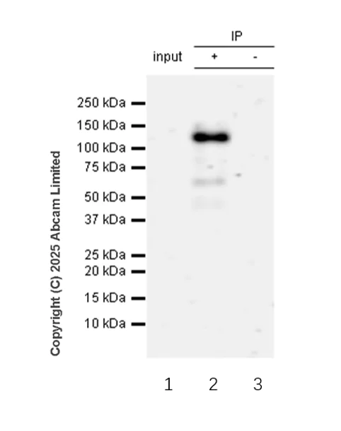 Immunoprecipitation - Anti-DDR1 (phospho Y796) + DDR2 (phospho Y740) antibody [EPR28699-33] - BSA and Azide free (AB323745)