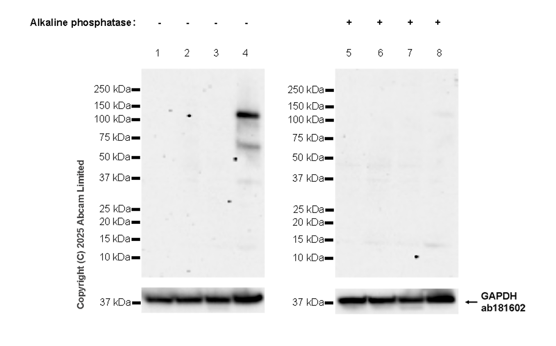 Western blot - Anti-DDR1 (phospho Y796) + DDR2 (phospho Y740) antibody [EPR28699-33] - BSA and Azide free (AB323745), expandable thumbnail
