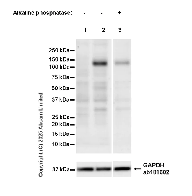 Western blot - Anti-DDR1 (phospho Y796) + DDR2 (phospho Y740) antibody [EPR28699-33] - BSA and Azide free (AB323745)