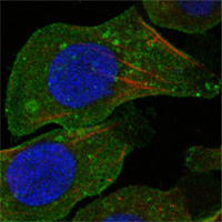 Immunocytochemistry/ Immunofluorescence - Anti-DDR2 antibody [3B11E4] (AB63337), expandable thumbnail