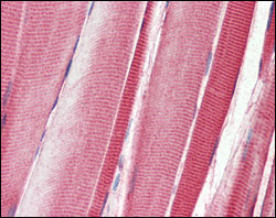 Immunohistochemistry (Formalin/PFA-fixed paraffin-embedded sections) - Anti-DDR2 antibody [3B11E4] (AB63337), expandable thumbnail