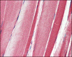 Immunohistochemistry (Formalin/PFA-fixed paraffin-embedded sections) - Anti-DDR2 antibody [3B11E4] (AB63337)