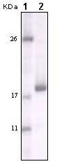 Western blot - Anti-DDR2 antibody [3B11E4] (AB63337), expandable thumbnail