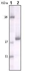 Western blot - Anti-DDR2 antibody [3B11E4] (AB63337)