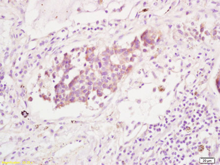 Immunohistochemistry (Formalin/PFA-fixed paraffin-embedded sections) - Anti-DDR2 antibody (AB203219)