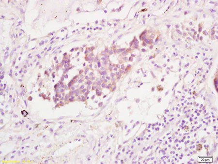 Immunohistochemistry (Formalin/PFA-fixed paraffin-embedded sections) - Anti-DDR2 antibody (AB203219)