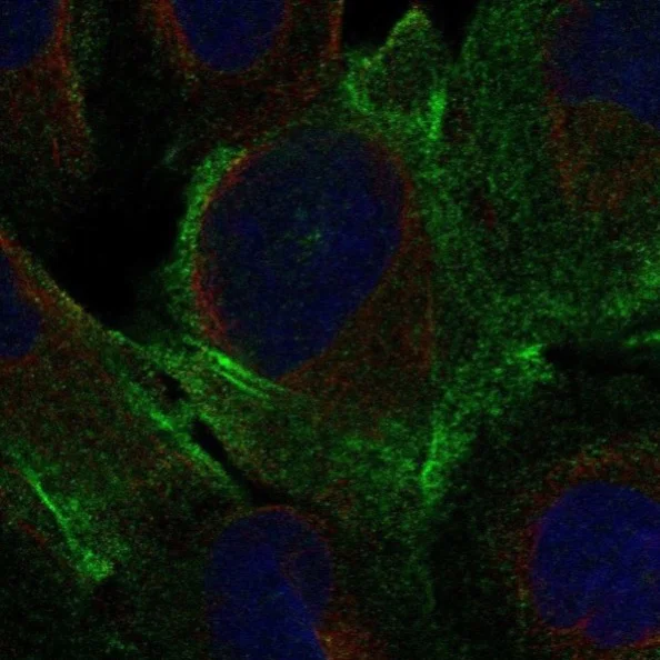 Immunocytochemistry/ Immunofluorescence - Anti-DDR2 antibody (AB221812)