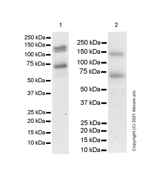 Western blot - Anti-DDR2 antibody [EPR18826-119] (AB280354)