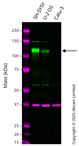 Western blot - Anti-DDR2 antibody [EPR18826-119] (AB280354)
