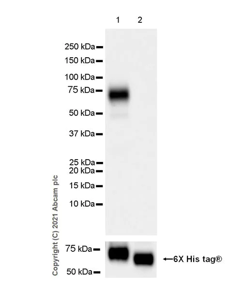 Western blot - Anti-DDR2 antibody [EPR18826-119] - BSA and Azide free (AB280369)