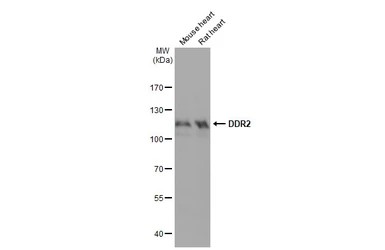 Western blot - Anti-DDR2 antibody [HL1107] - BSA and Azide free (AB313830), expandable thumbnail