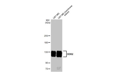 Western blot - Anti-DDR2 antibody [HL1107] - BSA and Azide free (AB313830), expandable thumbnail
