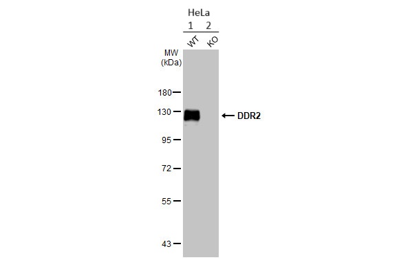 Western blot - Anti-DDR2 antibody [HL1107] - BSA and Azide free (AB313830), expandable thumbnail