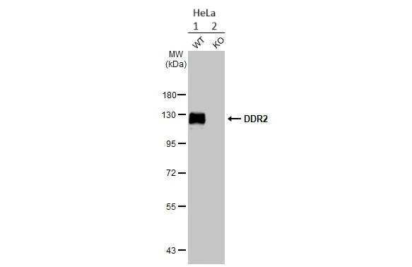 Western blot - Anti-DDR2 antibody [HL1107] - BSA and Azide free (AB313830)