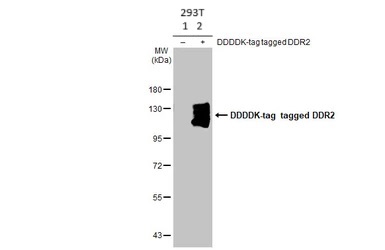 Western blot - Anti-DDR2 antibody [HL1107] - BSA and Azide free (AB313830), expandable thumbnail