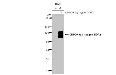 Western blot - Anti-DDR2 antibody [HL1107] - BSA and Azide free (AB313830)