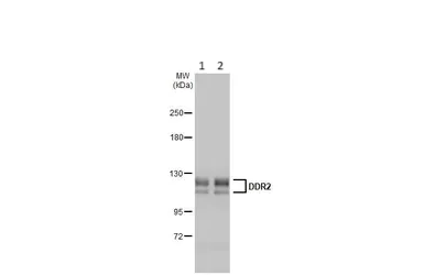 Western blot - Anti-DDR2 antibody [HL1107] - BSA and Azide free (AB313830)