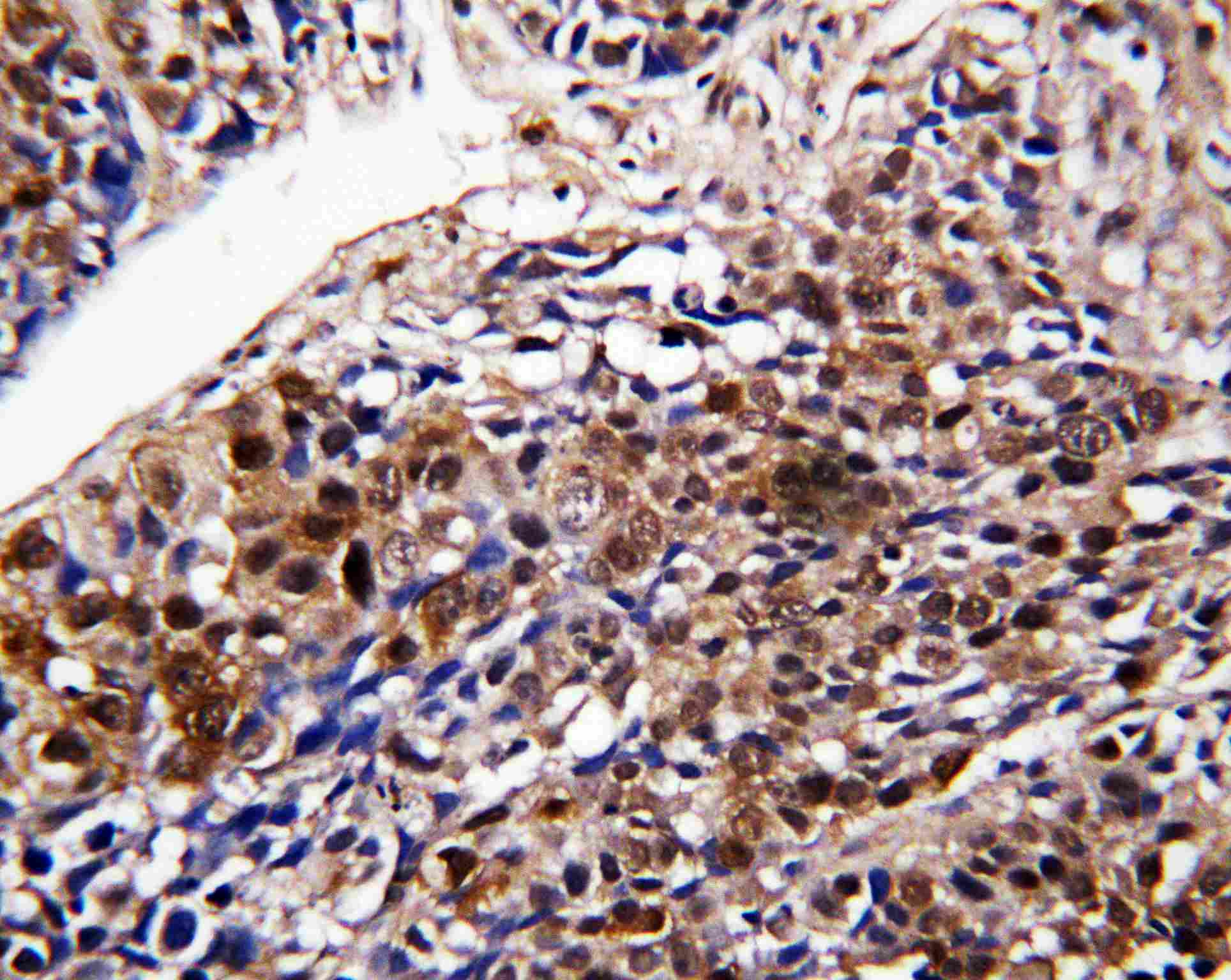 Immunohistochemistry (Formalin/PFA-fixed paraffin-embedded sections) - Anti-DDT antibody (AB115785), expandable thumbnail
