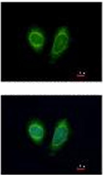 Immunocytochemistry/ Immunofluorescence - Anti-DDX1 antibody (AB151962), expandable thumbnail