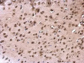 Immunohistochemistry (Formalin/PFA-fixed paraffin-embedded sections) - Anti-DDX1 antibody (AB151962)