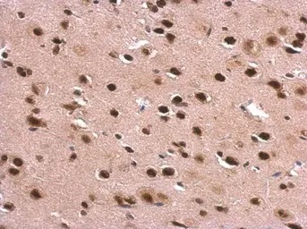 Immunohistochemistry (Formalin/PFA-fixed paraffin-embedded sections) - Anti-DDX1 antibody (AB151962)