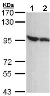 Western blot - Anti-DDX1 antibody (AB151962), expandable thumbnail