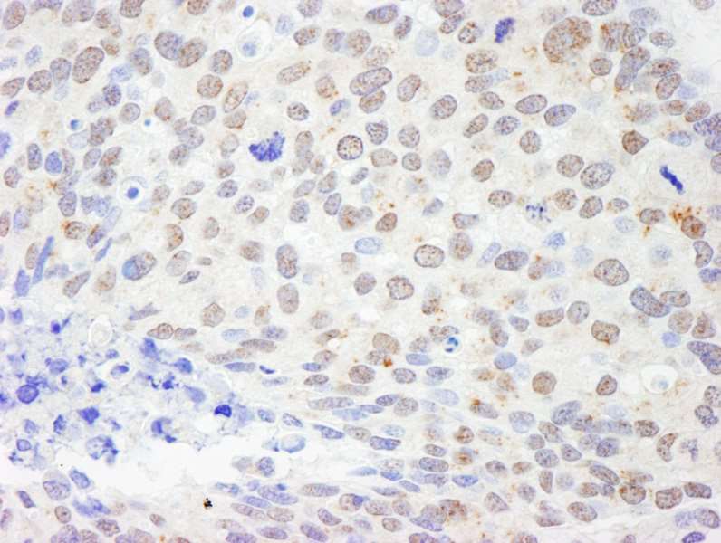 Immunohistochemistry (Formalin/PFA-fixed paraffin-embedded sections) - Anti-DDX1 antibody (AB264130)
