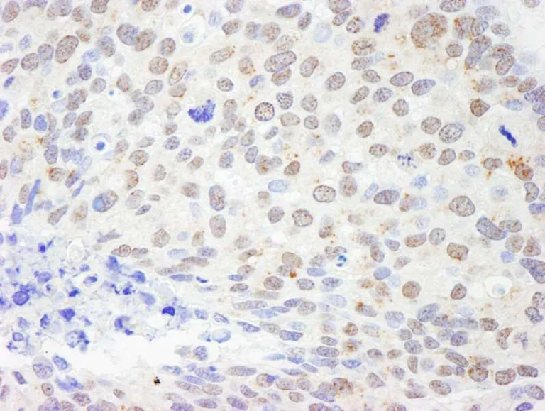 Immunohistochemistry (Formalin/PFA-fixed paraffin-embedded sections) - Anti-DDX1 antibody (AB264130)