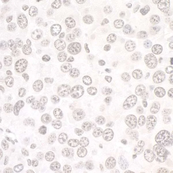 Immunohistochemistry (Formalin/PFA-fixed paraffin-embedded sections) - Anti-DDX1 antibody (AB70252)