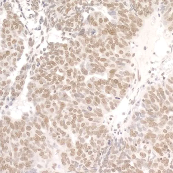 Immunohistochemistry (Formalin/PFA-fixed paraffin-embedded sections) - Anti-DDX1 antibody (AB70252)