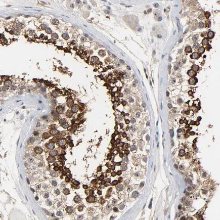 Immunohistochemistry (Formalin/PFA-fixed paraffin-embedded sections) - Anti-DDX10 antibody (AB243386)