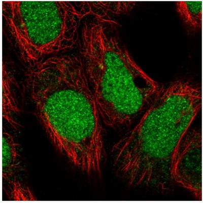 Immunocytochemistry/ Immunofluorescence - Anti-DDX11 antibody (AB204788), expandable thumbnail