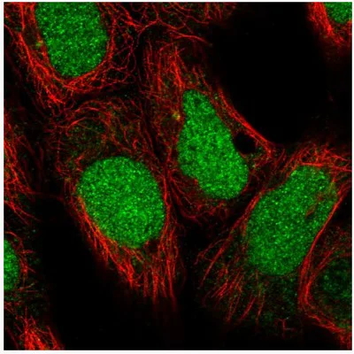 Immunocytochemistry/ Immunofluorescence - Anti-DDX11 antibody (AB204788)