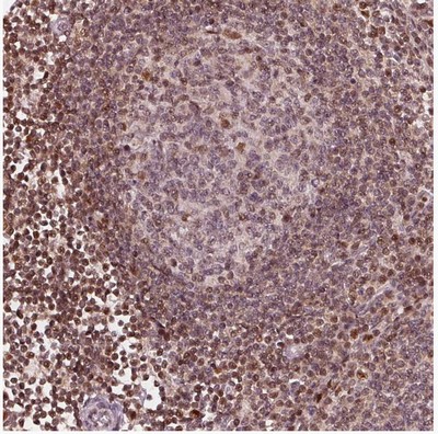 Immunohistochemistry (Formalin/PFA-fixed paraffin-embedded sections) - Anti-DDX11 antibody (AB204788), expandable thumbnail