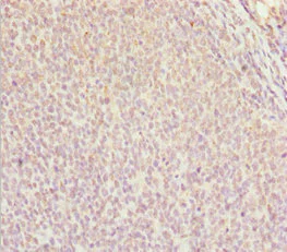 Immunohistochemistry (Formalin/PFA-fixed paraffin-embedded sections) - Anti-DDX11 antibody (AB230017)
