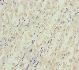 Immunohistochemistry (Formalin/PFA-fixed paraffin-embedded sections) - Anti-DDX11 antibody (AB230017)