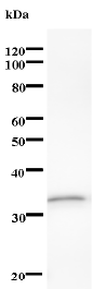 Western blot - Anti-DDX17 antibody [2248C2a] (AB71958)